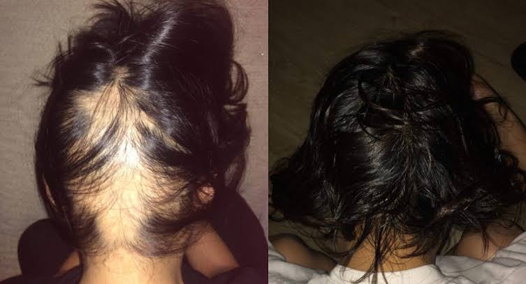 ChiqGuru Intense Hair Growth Oil