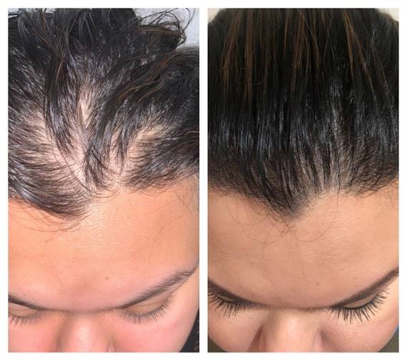ChiqGuru Intense Hair Growth Oil